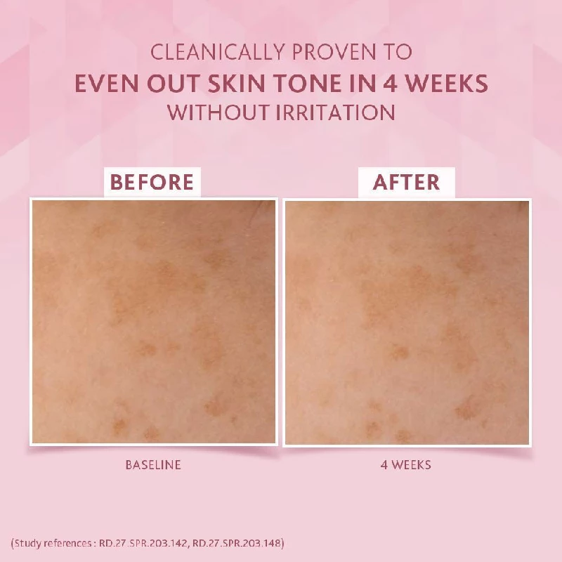 Cetaphil Brightening Night Cream with Niacinamide reduces Dark spots, 50 g-6.webp